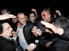 Столкновения в Тбилиси. Фото: newsru.com